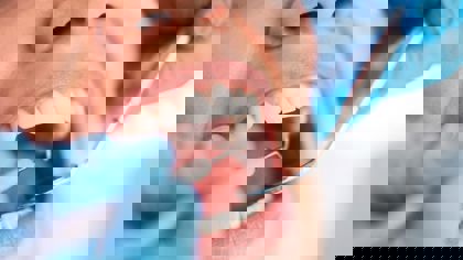 Dental products: The application of texture analysis on the latest developments