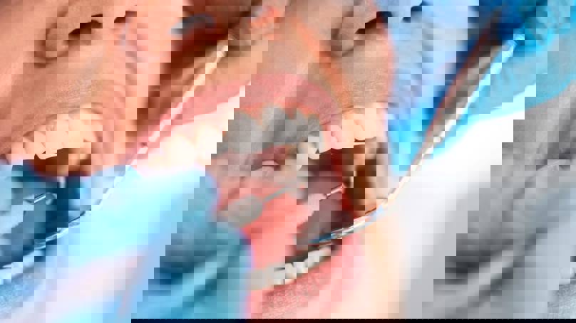 Woman Having Dental Check Up